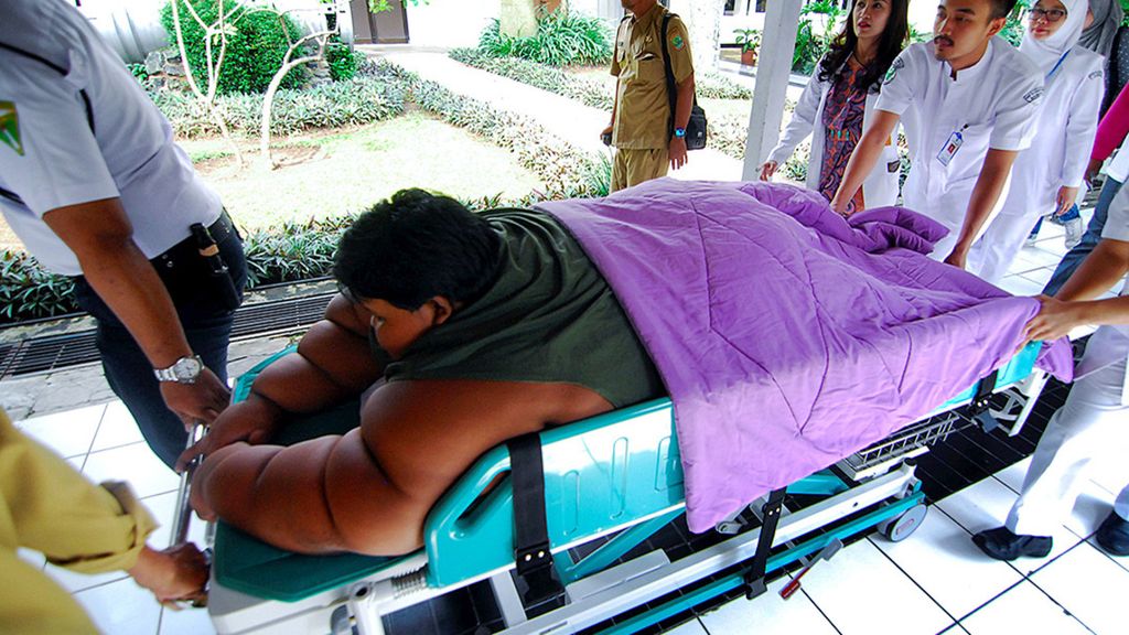 Sejumlah tim dokter membawa Arya Permana (10), anak dengan 'Severe Obesity' atau Kegemukan yang amat sangat untuk dirawat di Rumah Sakit Hasan Sadikin (RSHS), Bandung, Jawa Barat, Juli 2016. 