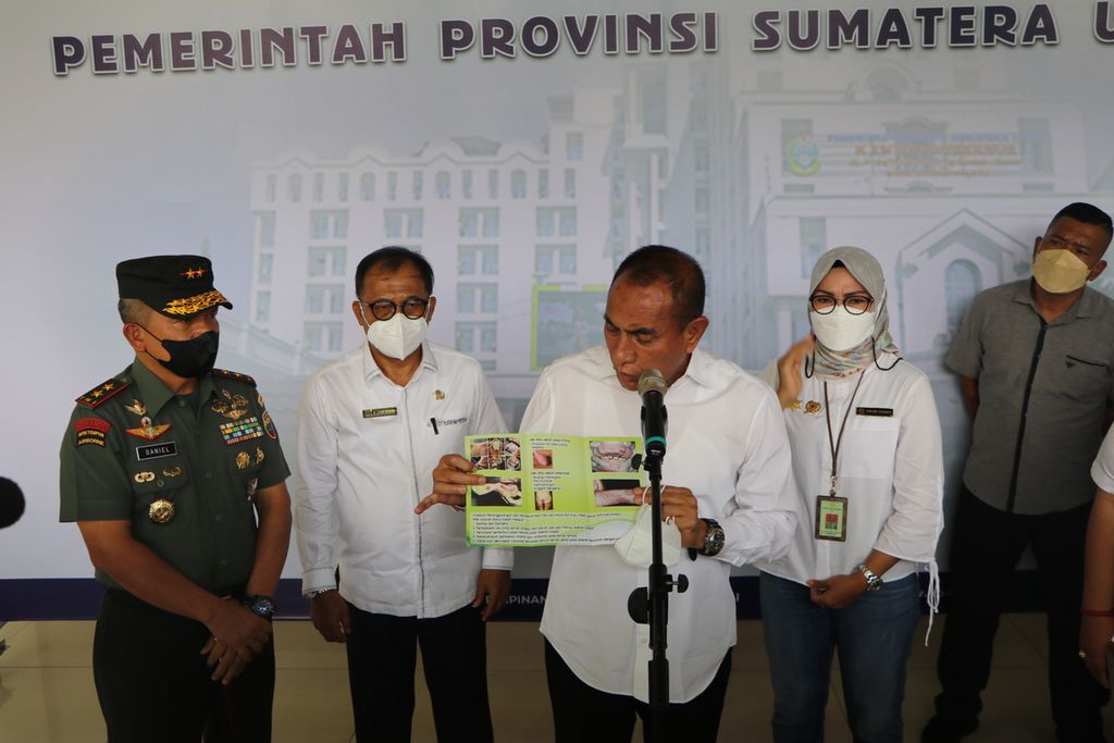 Gubernur Sumatera Utara Edy Rahmayadi menunjukkan brosur tentang kewaspadaan dalam menghadapi penyakit mulut dan kuku pada ternak seusai rapat bersama Kementerian Pertanian dengan pemerintah daerah se-Sumut, di Medan, Jumat (13/5/2022).